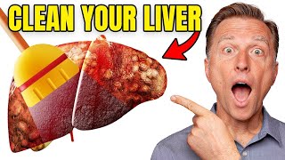 Top BEST Foods to Clean Out Your Liver [upl. by Erodaeht]