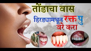 तोंडाचा वास घालवा फक्त १ मिनिटात  हिरड्यामधून रक्त पु येणे  Get Rid of Bad Breath Permanently [upl. by Assiluy807]