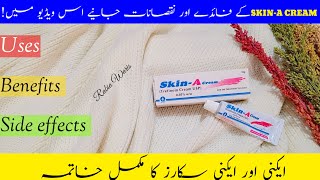 SkinA Cream Uses Benefits and Side effects Review  How to use SkinA cream  Tretinoin 005 [upl. by Annairdua]