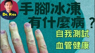 中英字幕EngSub手腳冰凍會有什麼病？教你簡單方法不花錢立即知道血管健康！cold hands and feet what are the implications [upl. by Aleunam99]