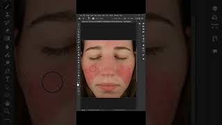 ازاله البقع الحمراء من الوجه remove red patches photoshoptricks photoshoptutorial photoshop [upl. by Weixel]