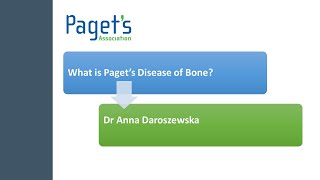 Pagets disease of bone  RadiographHISTOPATHOLOGYclinical features  NBDENEET MDSBDS  Diagrams [upl. by Luaped]