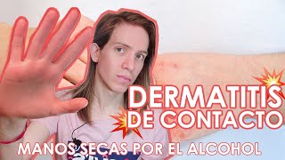 ¿COMO CUIDAR NUESTRAS MANOS DEL LAVADO FRECUENTE Dermatitis de Contacto Irritativa [upl. by Martica492]