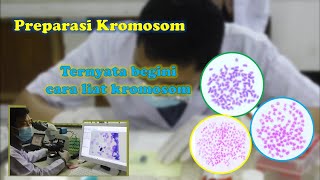 Preparasi kromosom ikan [upl. by Gilbertson]