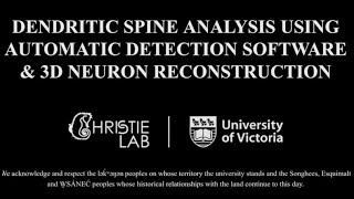 Dendritic Spine Analysis amp 3D Neuron Reconstruction Neurolucida 360 [upl. by Tippets887]