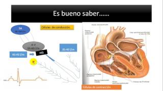 ANTIARRÍTMICOS  INTRODUCCIÓN  CLASIFICACIÓN Y MECANISMO DE ACCIÓN GENERAL  13 [upl. by Lemieux630]