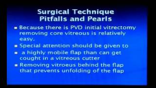 Giant retinal tear Prof Dr hany hamza [upl. by Mourant]