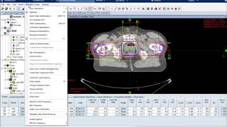 Eclipse Dose Calculation [upl. by Nesline]