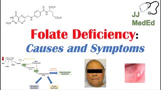 Folate Deficiency Causes ex medications Pathogenesis Symptoms Diagnosis and Treatment [upl. by Claudio]