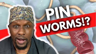 Pinworms Symptoms Treatments and Prevention [upl. by Brandon]