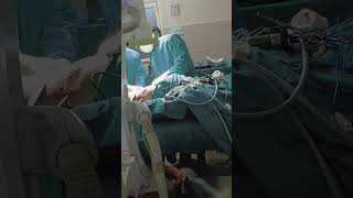 hospital adayinmedicalcollege youtubeshorts froximultibia facture for plating during inoperation [upl. by Binky]