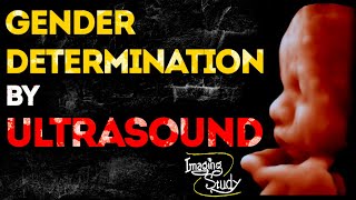 Gender Determination by Ultrasound  Imaging Study Lecture [upl. by Ramsden949]