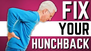 Top 10 Exercises to Stop Hunchback Kyphosis Forward Head Posture [upl. by Nage]