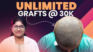 Unlimited Grafts in Hair Transplant Myth or Reality 🤔  New Roots Hair Clinic [upl. by Eon]