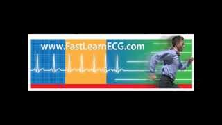 12lead ECGEKG Differentiating between atrial and ventricular arrhythmias [upl. by Enilesoj970]