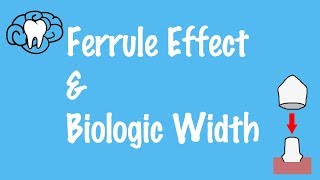 Ferrule Effect and Biologic Width [upl. by Yeltnerb]