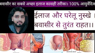 hemorrhoidspilesवबासिर का 100आयुर्वेदिक इलाज।💯💯helthHemoroyids [upl. by Anom]