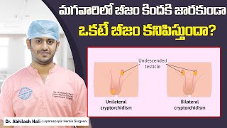 What is Undescended Testicle and How to Treat That  Cryptorchidism Causes  Dr Abhilash Nali [upl. by Ahsuatan698]