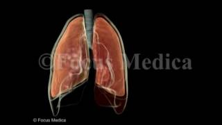 Hemothorax  Lungs [upl. by Maxma582]