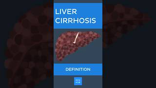 Liver cirrhosis Definition  Kenhub livercirrhosis [upl. by Osber742]