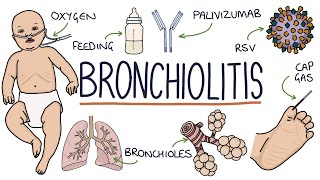 Understanding Bronchiolitis [upl. by Dlonyer214]