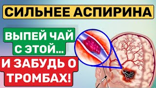 РАЗЖИЖАЕТ ЛУЧШЕ АСПИРИНА Эти продукты позволят навсегда забыть о тромбах и густой крови [upl. by Yspyg497]