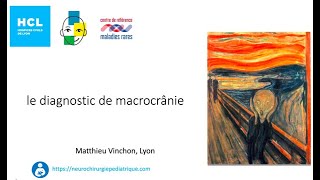 le diagnostic de macrocrânie [upl. by Dennison]