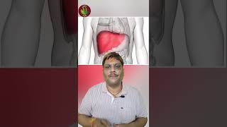 hepatomegaly hepatomegalyremedies hepatomegalycure enlargeliver fattyliver यकृतवृद्धि [upl. by Fregger]