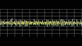 Glandular Balance  Rife Frequencies [upl. by Chura]