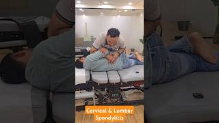 Cervical and Lumbar Spondylitis Treatment in India DrMushtaque 🇮🇳 chiropractor Migren sciatica [upl. by Aniuqaoj]