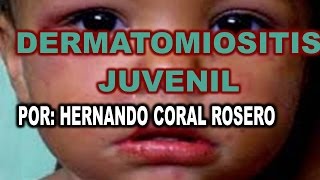 DERMATOMIOSITIS JUVENIL  ENFERMEDAD QUE AFECTA A NIÑOS QUE GENERAN PARCHES ROSADOS [upl. by Terraj73]