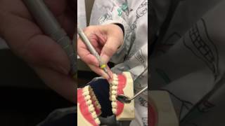 Instrumentation on Maxilla Universal Curettes part 2 [upl. by Etteyniv]