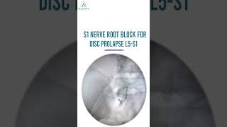 S1 Nerve Root Injection For Disc Prolapse  L5 S1 Under Fluoroscopy Guidance [upl. by Hait111]