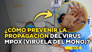 ¿Cómo se contagia el virus mpox o viruela del mono LASCOSASRPP  ENTREVISTA [upl. by Felipe]