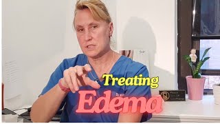 Treating Edema [upl. by Dott]