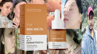 Dermatouch Kojic Acid Serum  Honest Review [upl. by Naut]