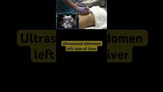 Ultrasound Abdomen left liver lobe [upl. by Gruchot]