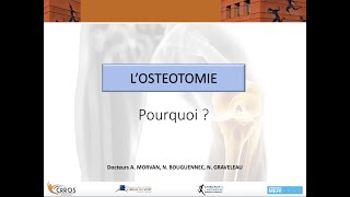 Pourquoi faire une ostéotomie [upl. by Vikky]