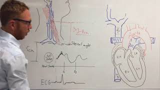 Jugular venous pressure [upl. by Naitsihc]