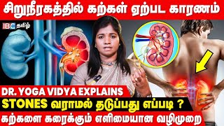 How Kidney Stones are Formed Tamil [upl. by Mischa122]