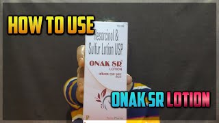 ONAK SR Resorcinolsulfur lotion amp Pretibenzyl 5 lotion BENZYL PEROXIDE review in Hindi [upl. by Litman]