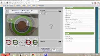 Retinoscopy Simulator Tutorial SPHCYL Method [upl. by Aehsel]