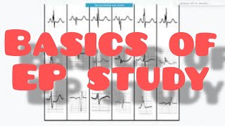 Cardiac Electrophysiologist In Action [upl. by Esydnac67]