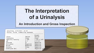 Interpretation of the Urinalysis Part 1  Introduction and Inspection [upl. by Bergquist]