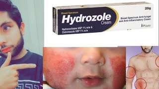 Hydrozole cream usehydrozole cream full reviewrashes on baby hipsskin infection treatment [upl. by Nohsar]