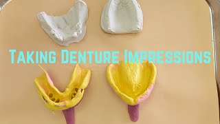 Taking Denture Impressions [upl. by Yblek]