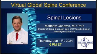 quotSpinal Lesionsquot with Dr Matthew Goodwin June 13 2024 [upl. by Lavella665]