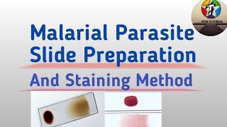 Malarial Parasite Slide Preparation And staining Method [upl. by Annaehs]