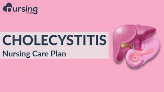 Understanding Cholecystitis and how to care for it Nursing Care Plan [upl. by Rosene]