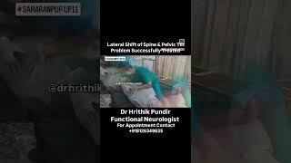 Lateral Shift of Spine amp Pelvic Tilt Successful Treat drhrithikpundir trending viralvideo shorts [upl. by Eneluqcaj906]